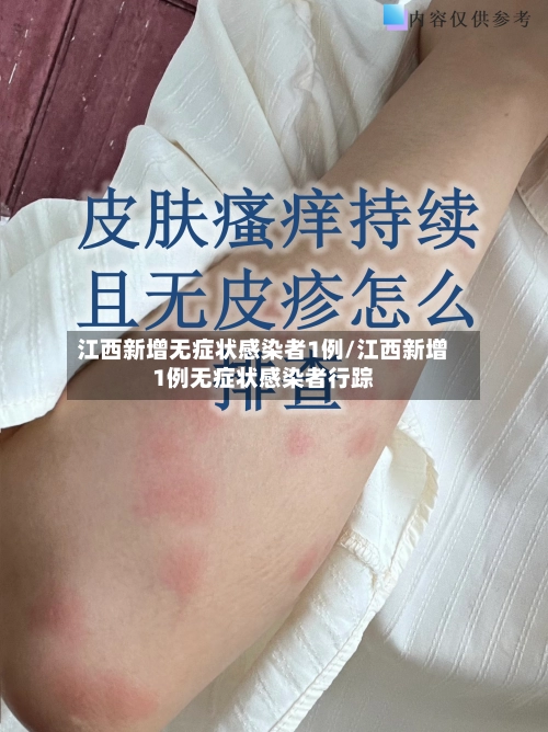 江西新增无症状感染者1例/江西新增1例无症状感染者行踪-第2张图片