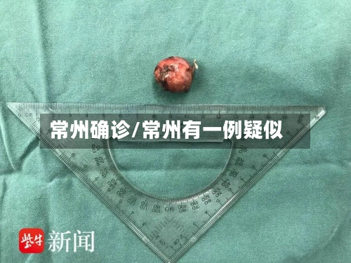 常州确诊/常州有一例疑似