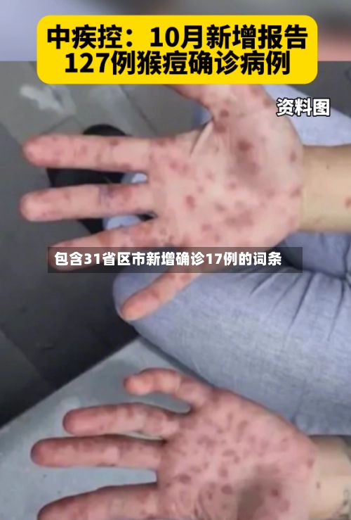 包含31省区市新增确诊17例的词条-第2张图片