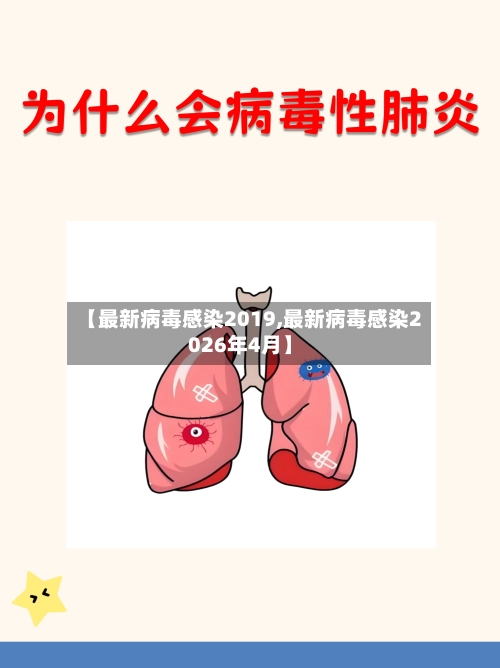 【最新病毒感染2019,最新病毒感染2026年4月】-第3张图片